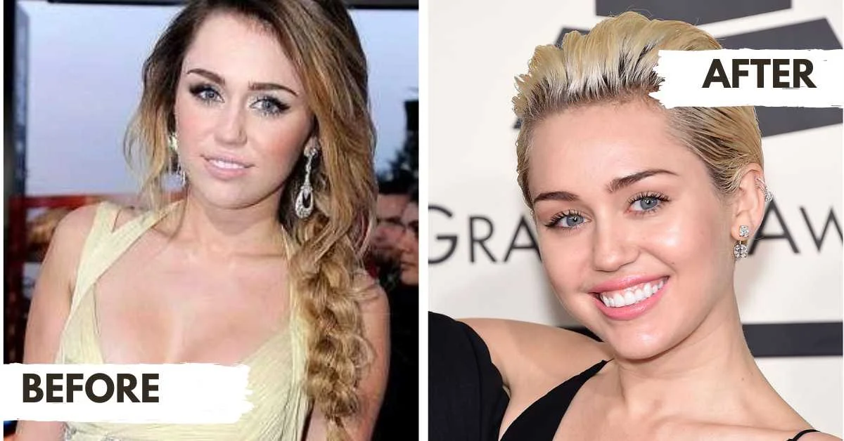 Miley Cyrus Plastic Surgery Rumors