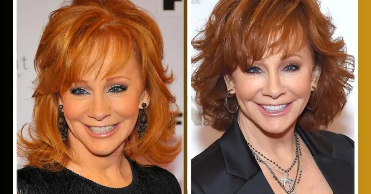 What Were The Reasons Behind Reba Mcentire Lips 