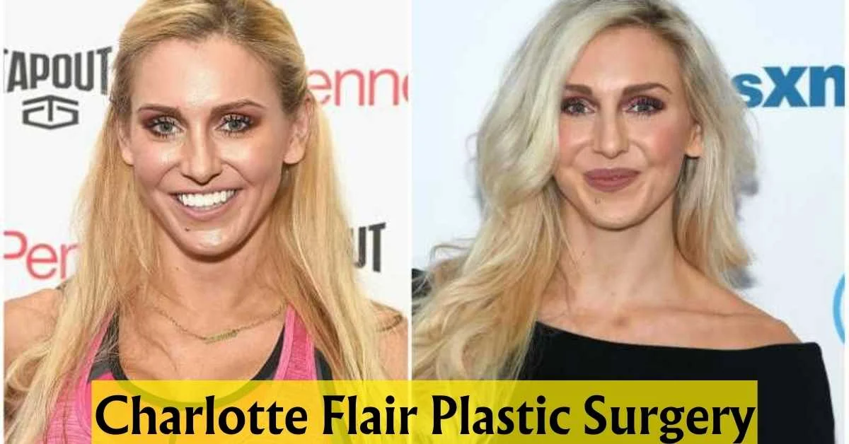 Charlotte Flair Plastic Surgery