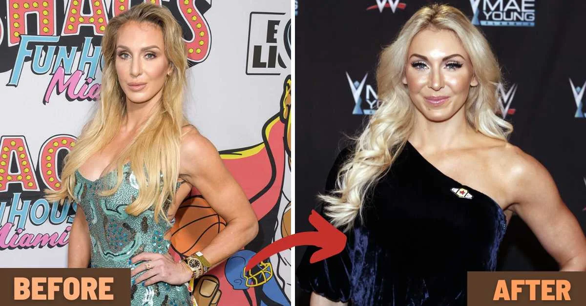 Charlotte Flair Plastic Surgery 