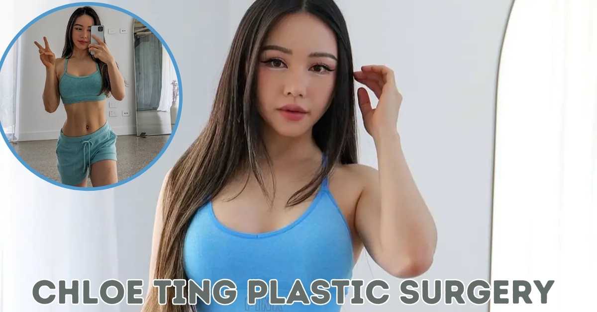 Chloe Ting Plastic Surgery