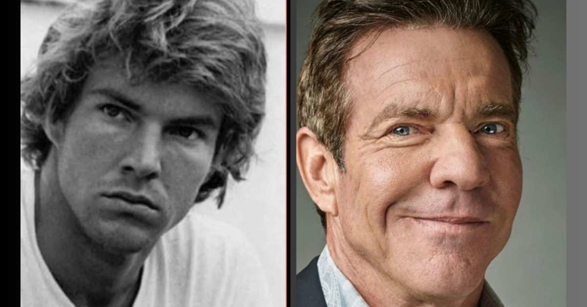 Dennis Quaid Before and After