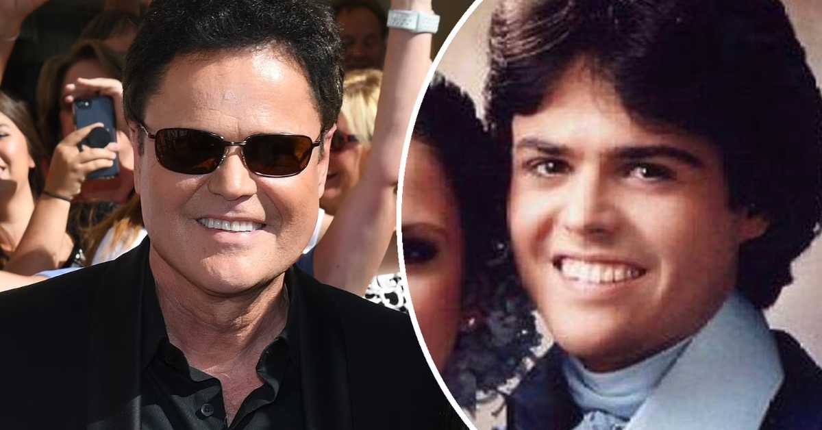 Donny Osmond Plastic Surgery