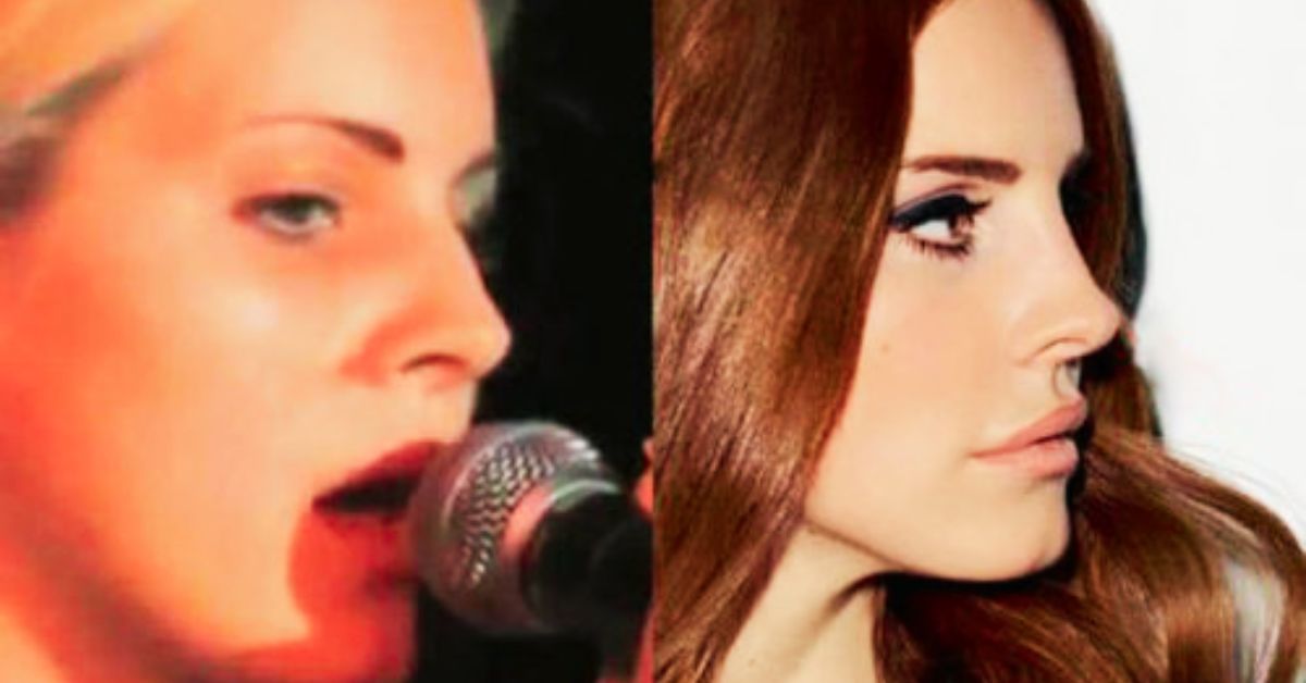 Lana Del Rey's Nose Transformation