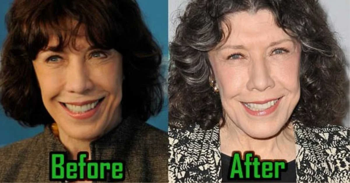 Lily Tomlin Plastic Surgery