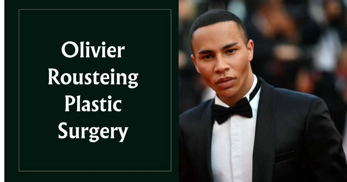 Olivier Rousteing Plastic Surgery