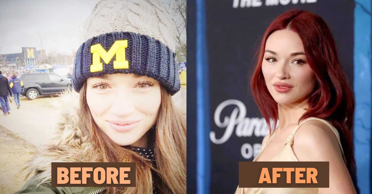 crystal reed plastic surgery