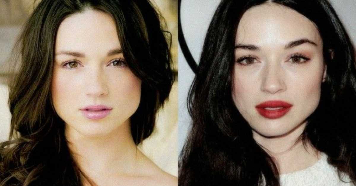 crystal reed plastic surgery