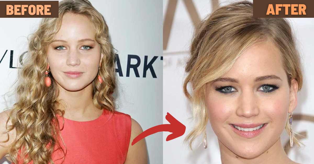 did jennifer lawrence get plastic surgery