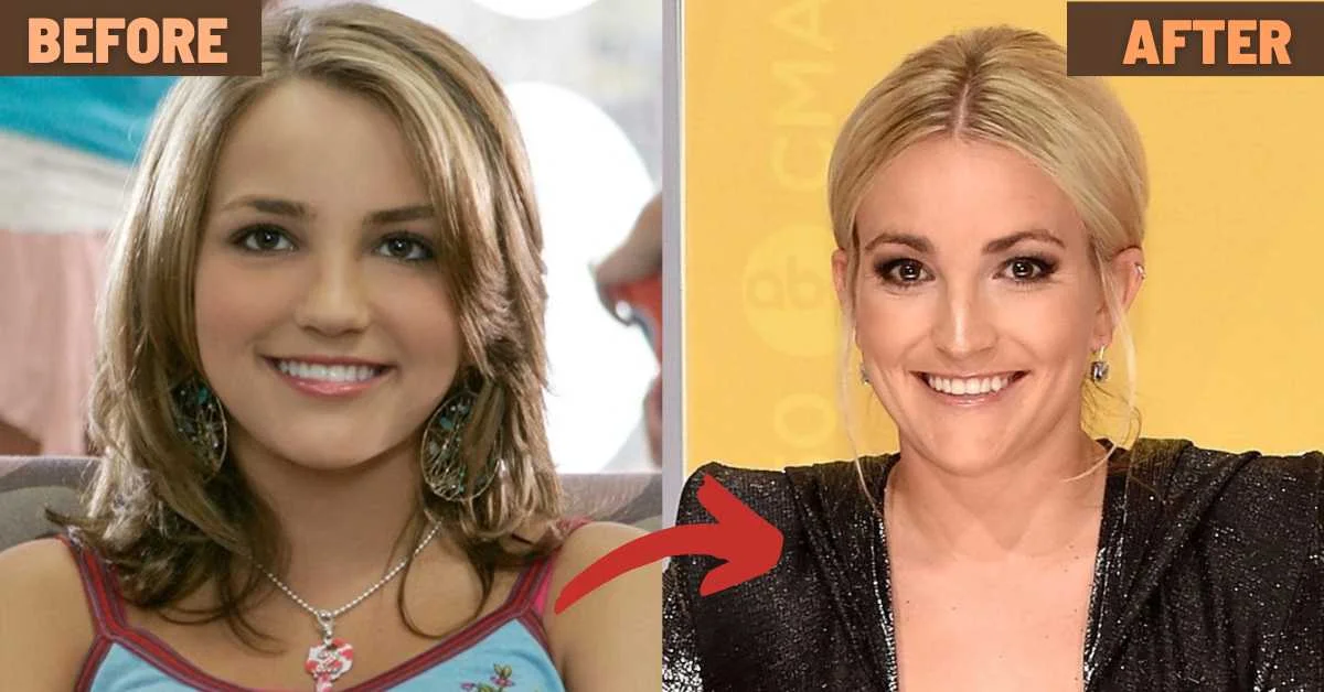 jamie lynn spears plastic surgery