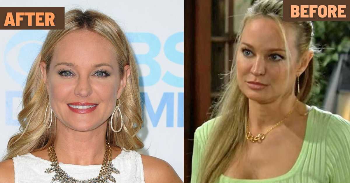 sharon case plastic surgery