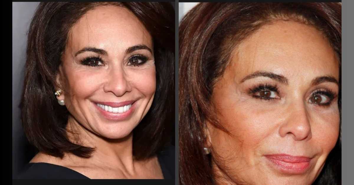 Judge Jeanine Left Eye Unveiling The Truth Behind The Eyepatch!