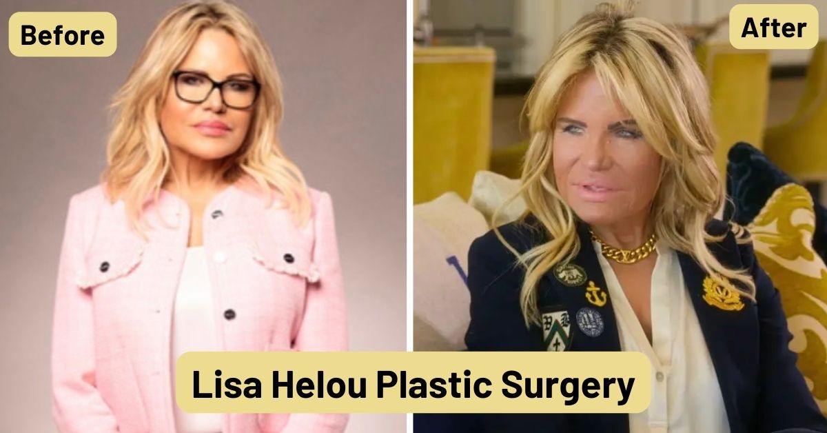 Did Lisa Helou Undergo Plastic Surgery? Unveiling The Transformation