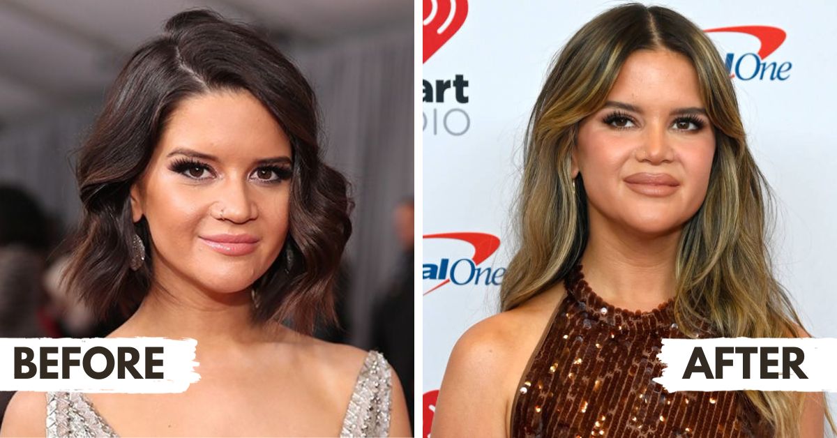 Maren Morris Plastic Surgery