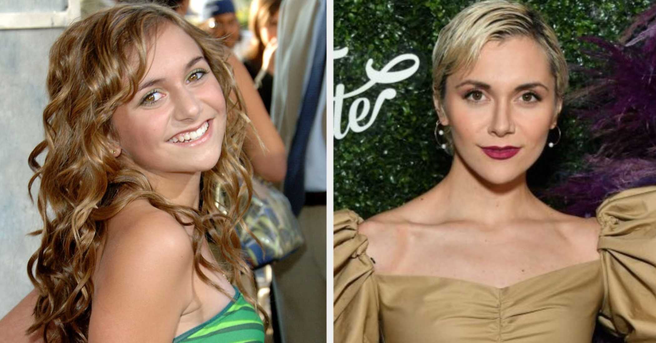 alyson stoner plastic surgery 