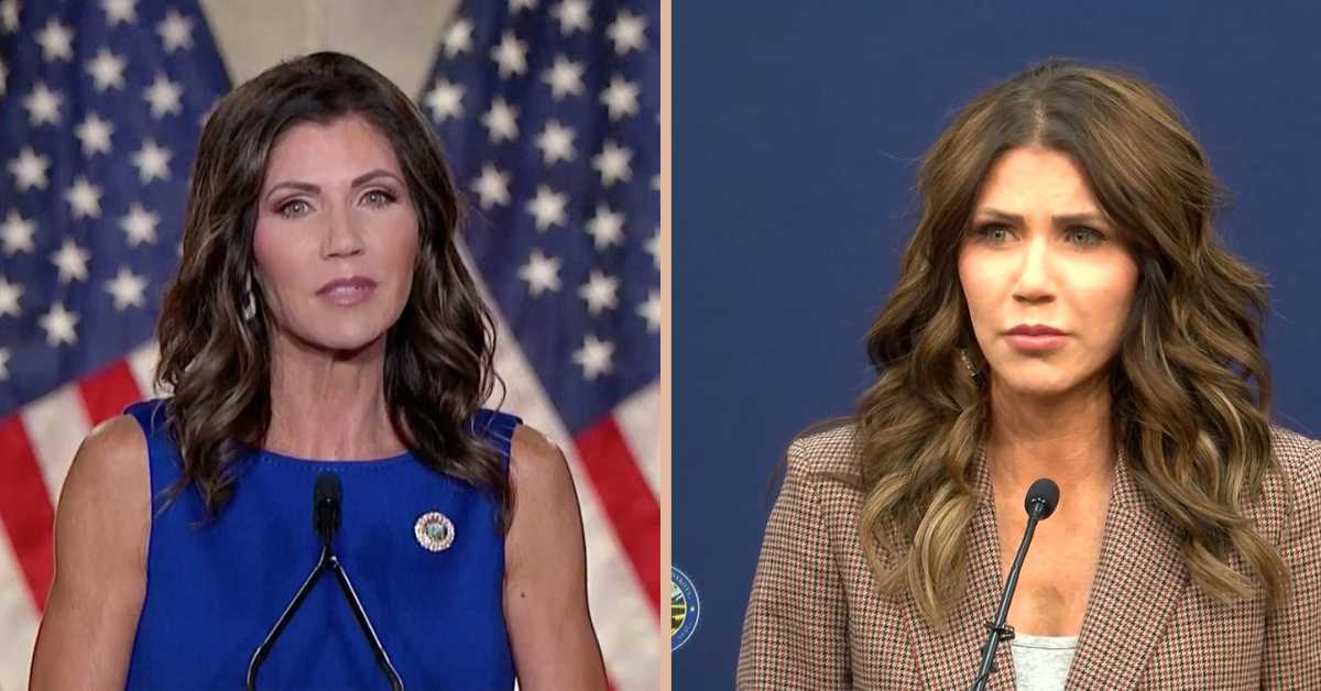 kristi noem plastic surgery 