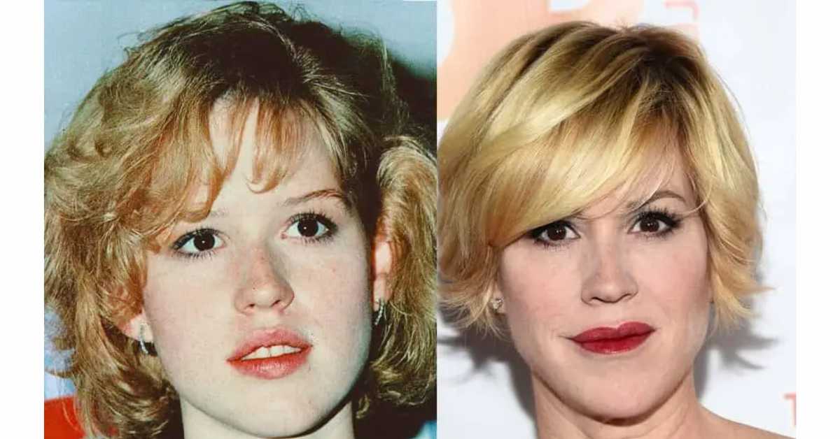 molly ringwald plastic surgery