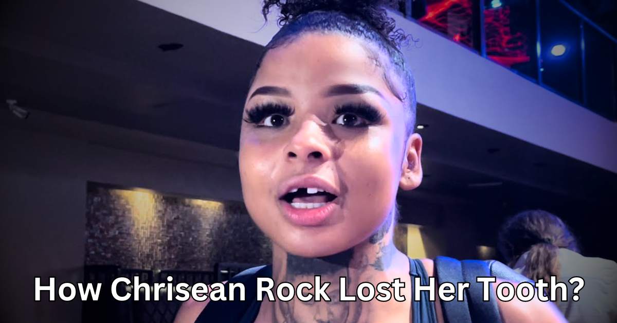 How Chrisean Rock Lost Her Tooth