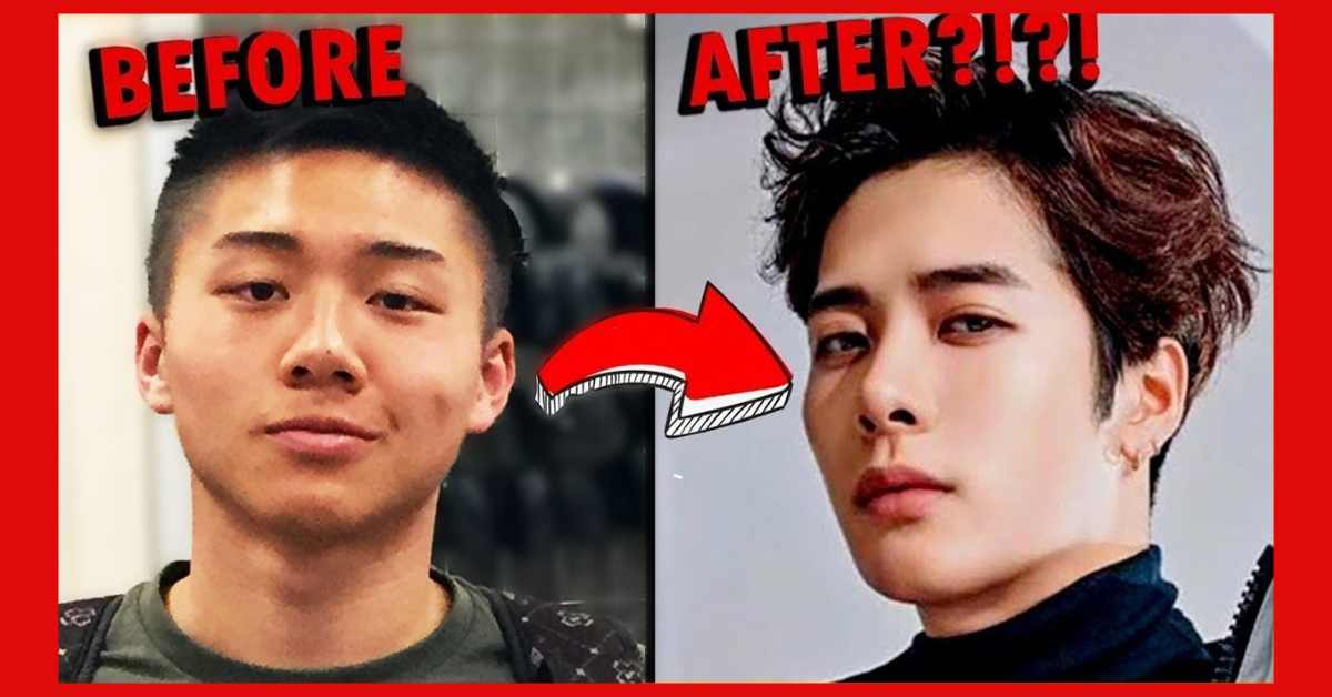 Jackson Wang Plastic Surgery