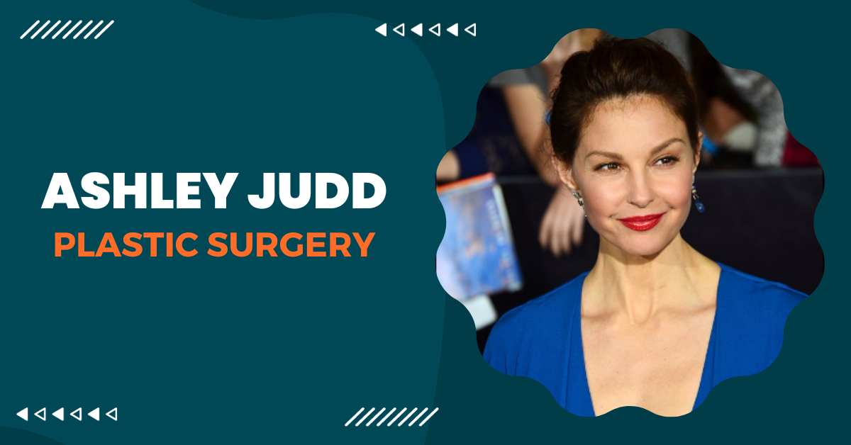 Ashley Judd Plastic Surgery