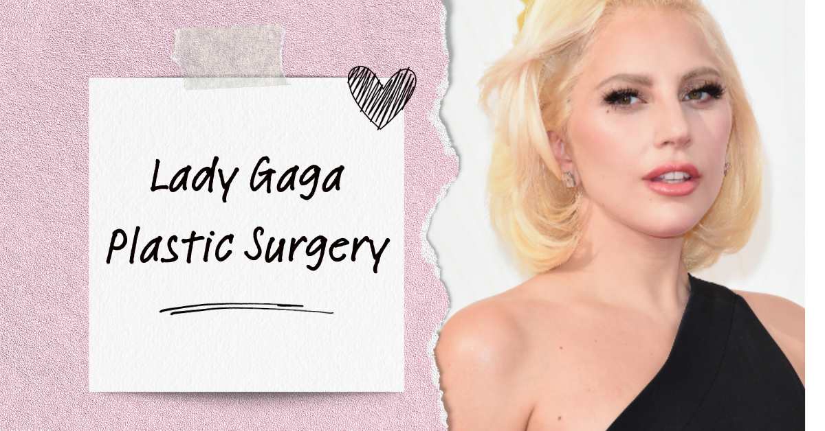 Lady Gaga Plastic Surgery