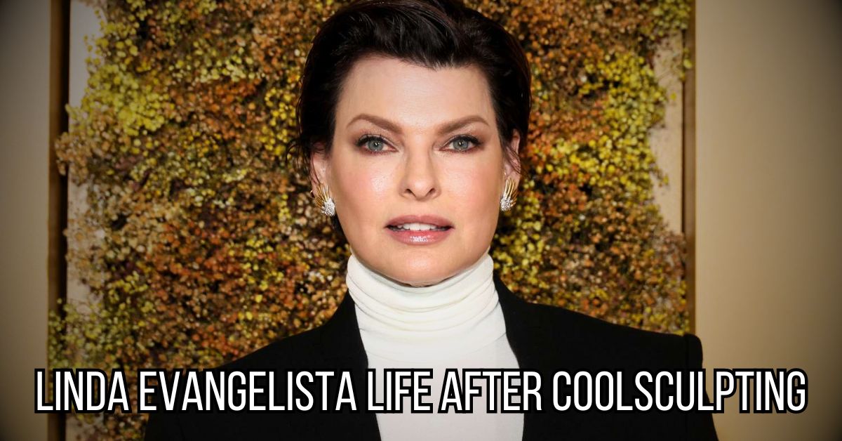 Linda Evangelista Life After CoolSculpting