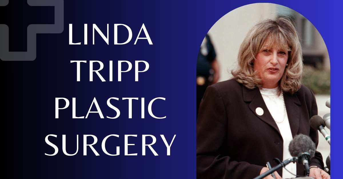 Linda Tripp Plastic Surgery