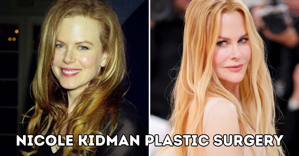 Nicole Kidman Plastic Surgery