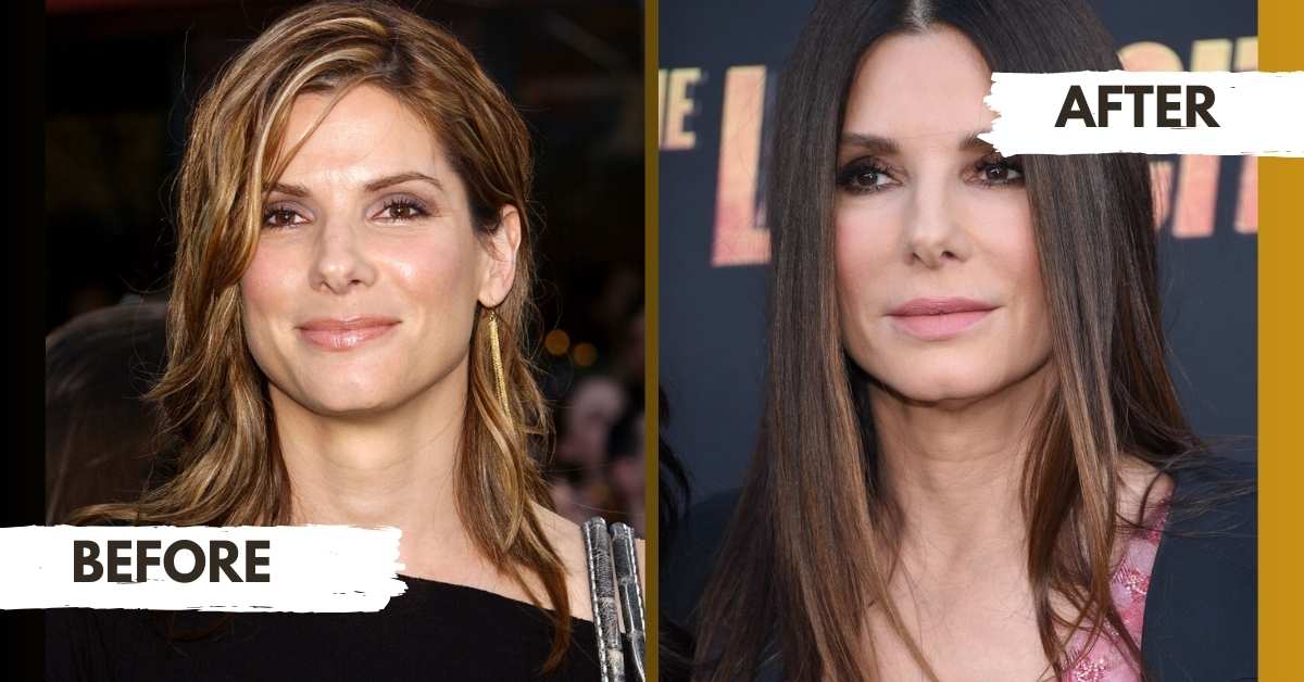 Sandra Bullock Before and After