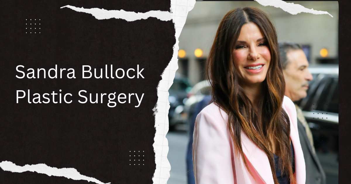 Sandra Bullock Plastic Surgery