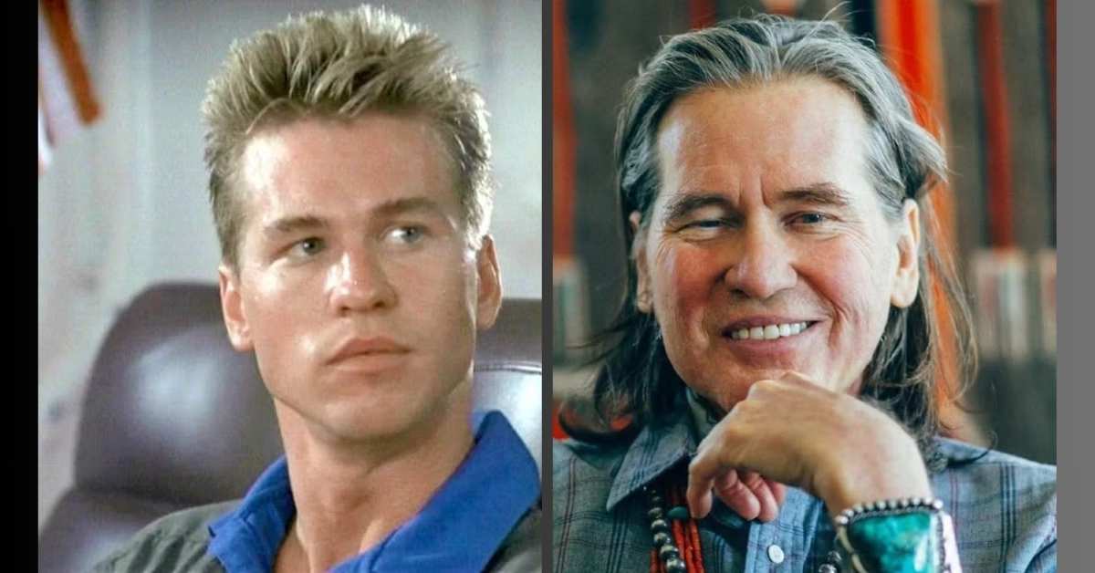 Val Kilmer Plastic Surgery Before and After