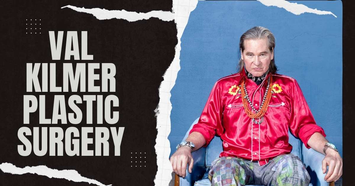 Val Kilmer Plastic Surgery