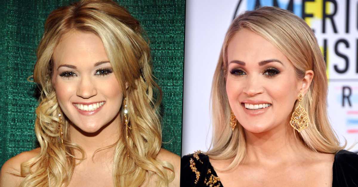 carrie underwood plastic surgery 