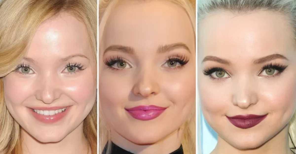 dove cameron plastic surgery