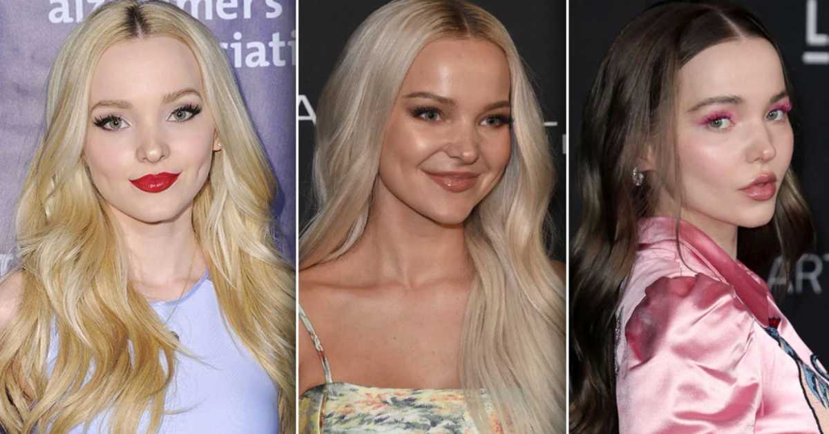 Dove Cameron Plastic Surgery: New Look And Transformation Journey