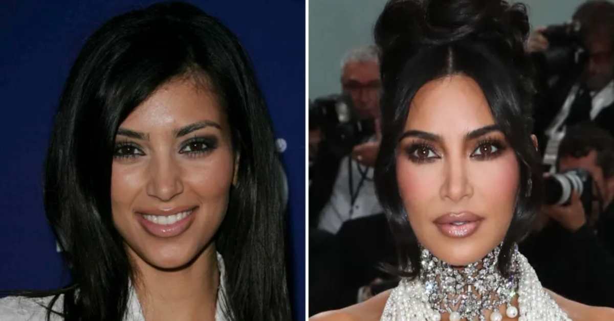 kim kardashian before plastic surgery