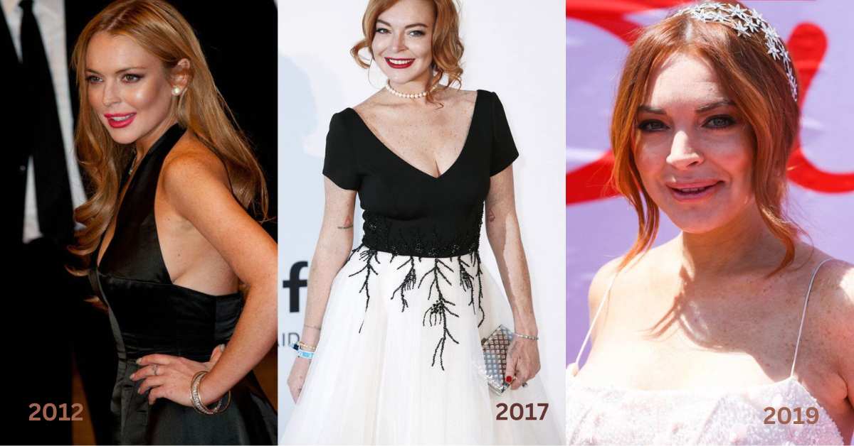 lindsay lohan plastic surgery