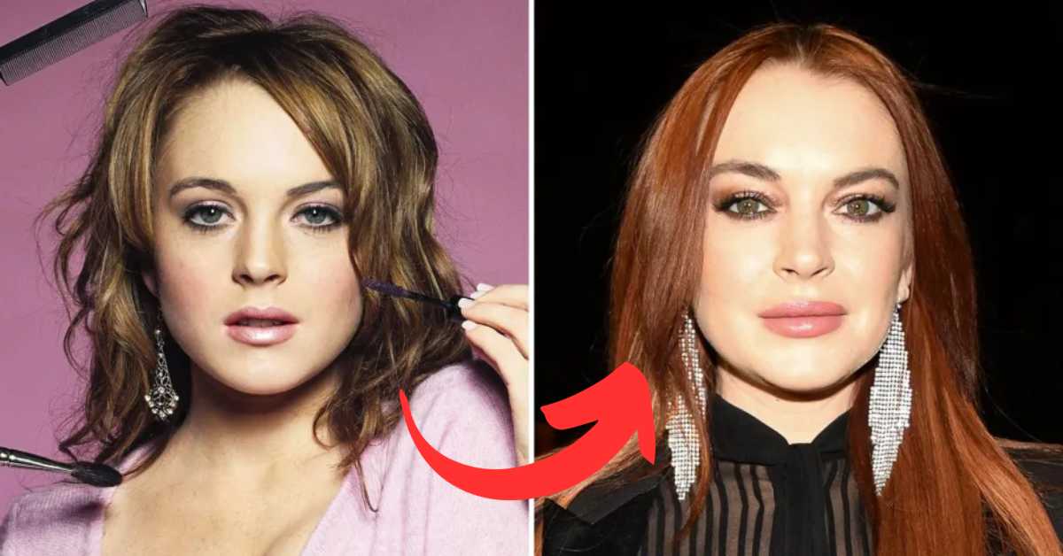 lindsay lohan plastic surgery (2)