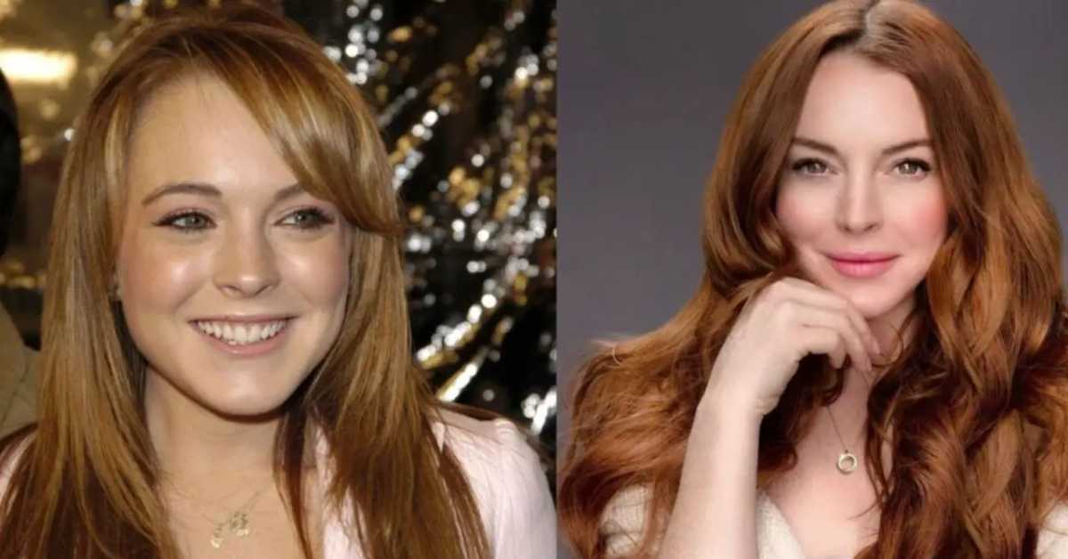 lindsay lohan plastic surgery (2)