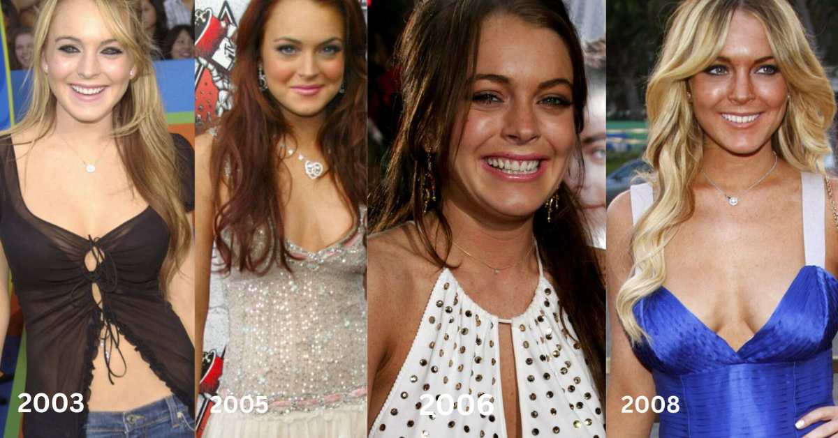 lindsay lohan plastic surgery