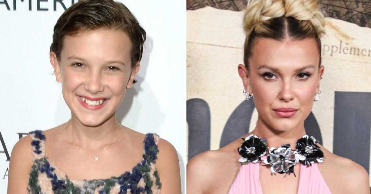 millie bobby brown plastic surgery