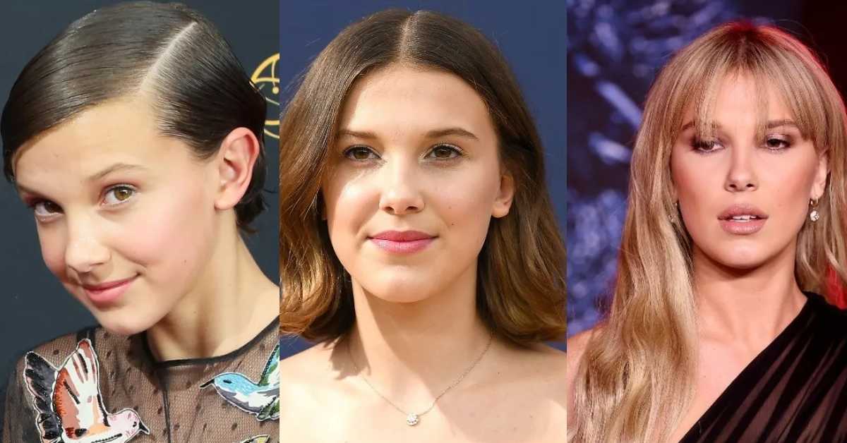 millie bobby brown plastic surgery