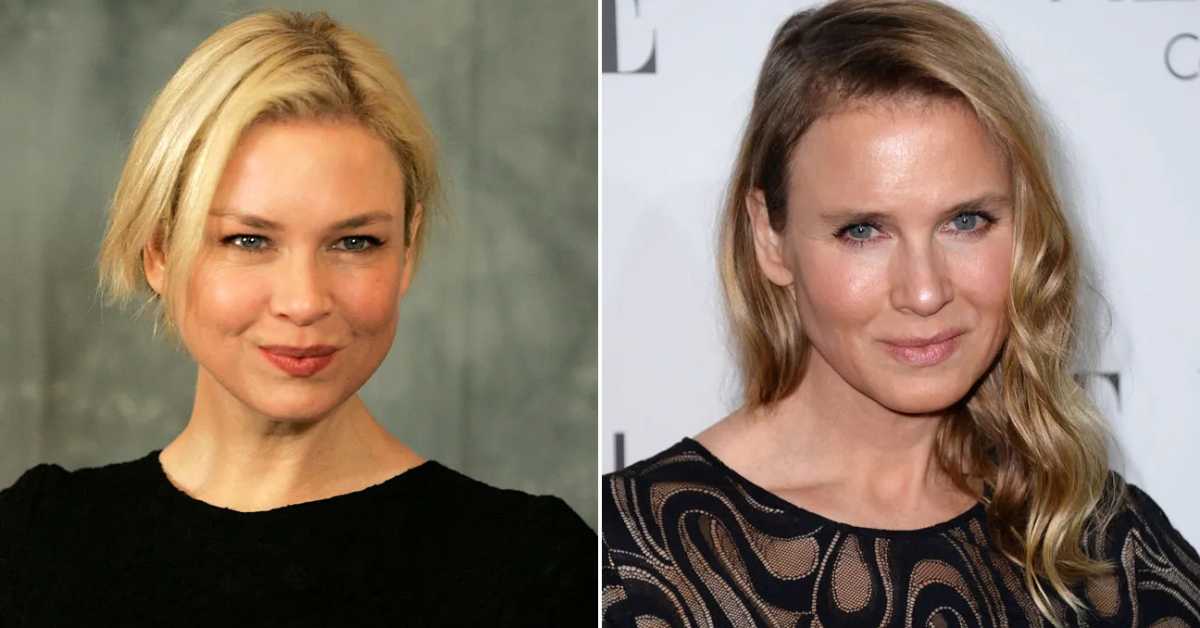 renee zellweger plastic surgery 