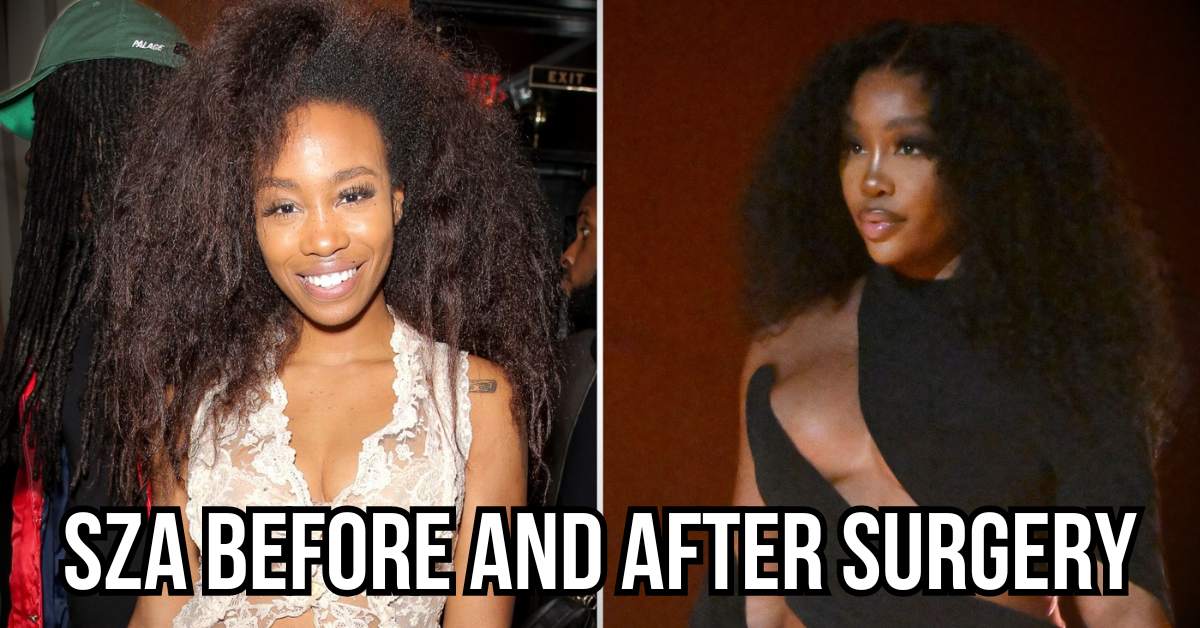 SZA's Transformation: Before and After Surgery - Setting the Record Straight