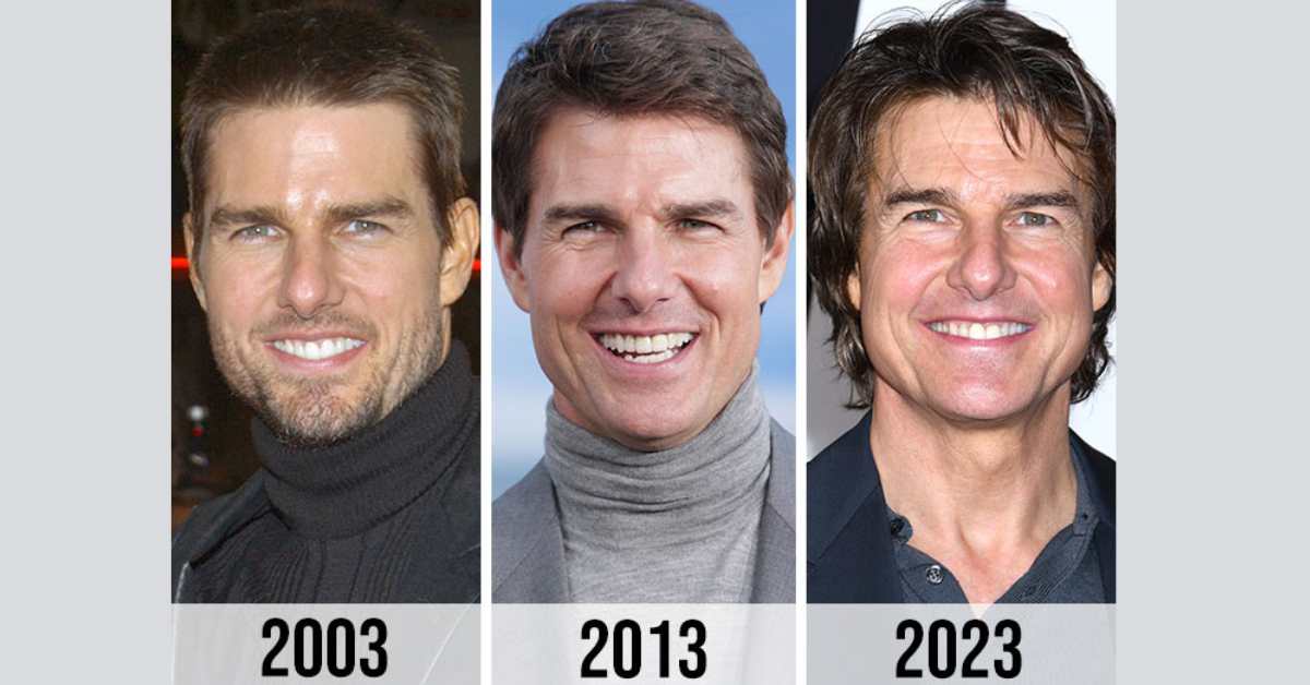 tom cruise plastic surgery 