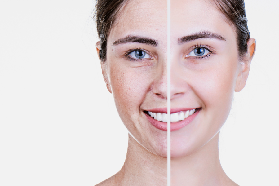 6 Different Methods for Teeth Whitening for 2024