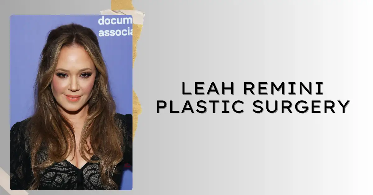 leah remini plastic surgery