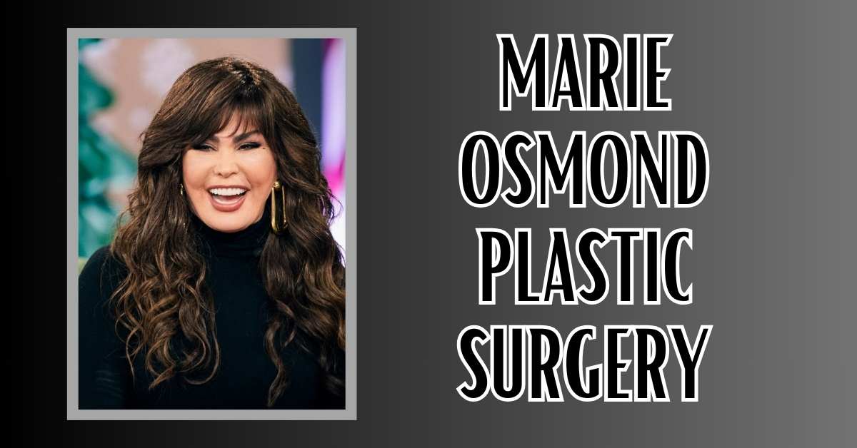 Marie Osmond Plastic Surgery