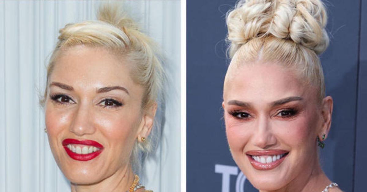 Gwen Stefani Plastic Surgery