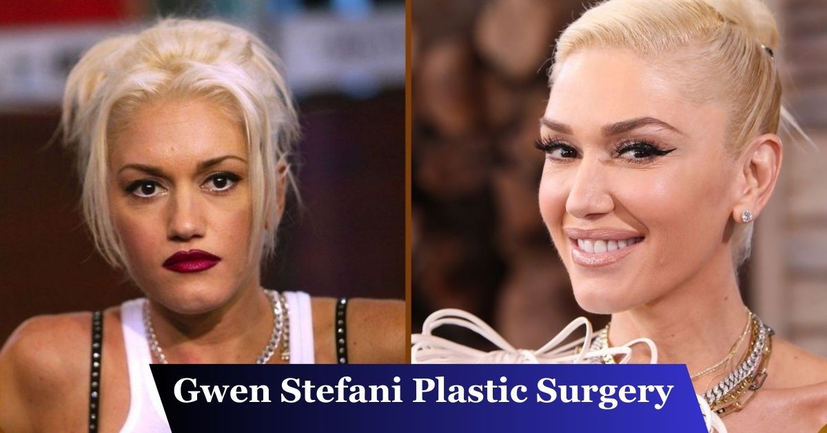 Gwen Stefani Plastic Surgery